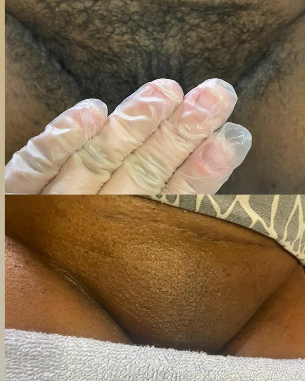 Pics of brazilian waxes #6